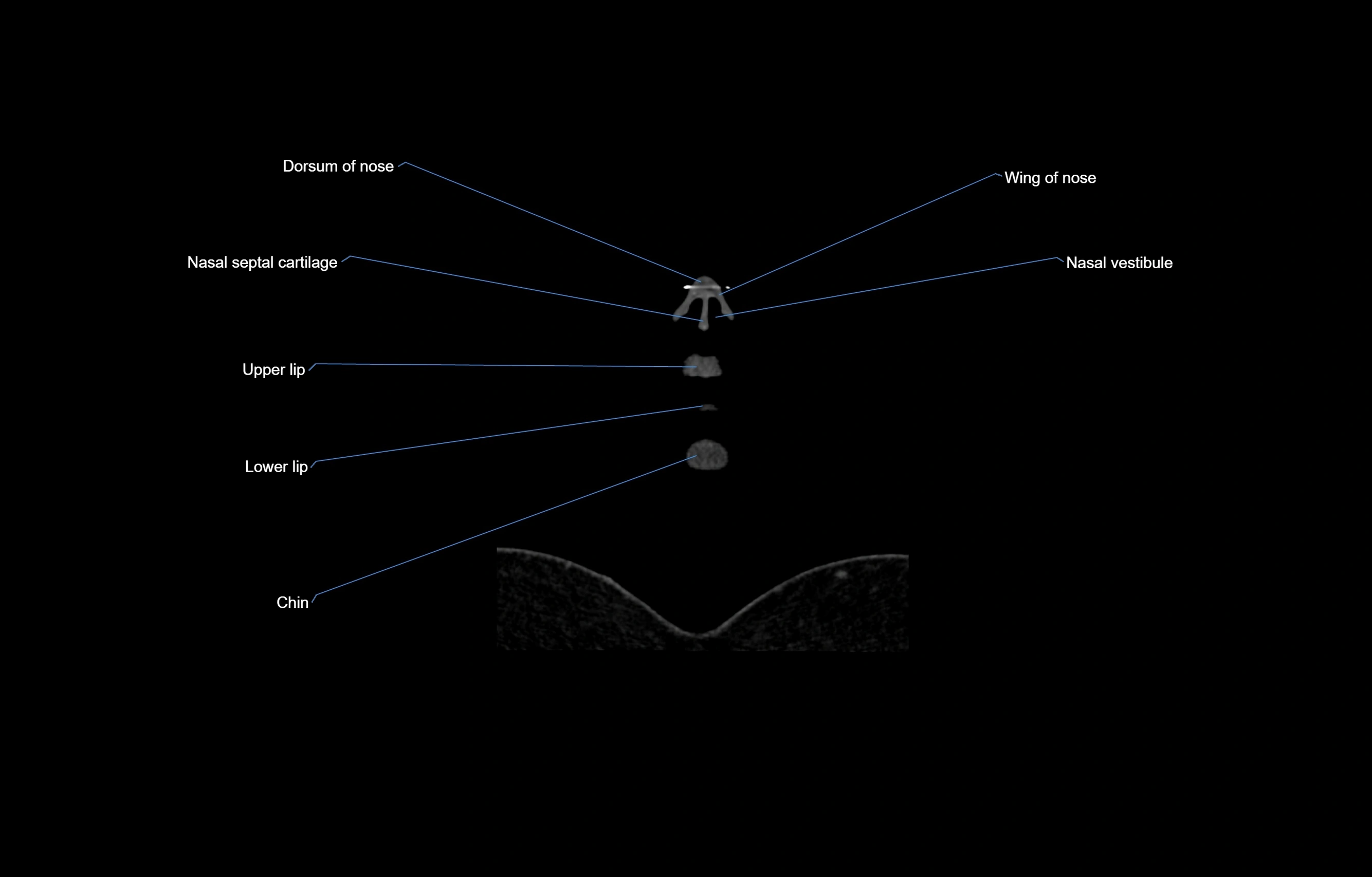 CT Neck coronal  cross sectional anatomy labelled 3D  radiology  image-00003.webp